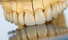 Prothetik (Zahnersatz)